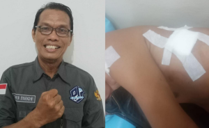 Brutal! Hendri Ditusuk di Kertapati, Pelaku Masih Berkeliaran